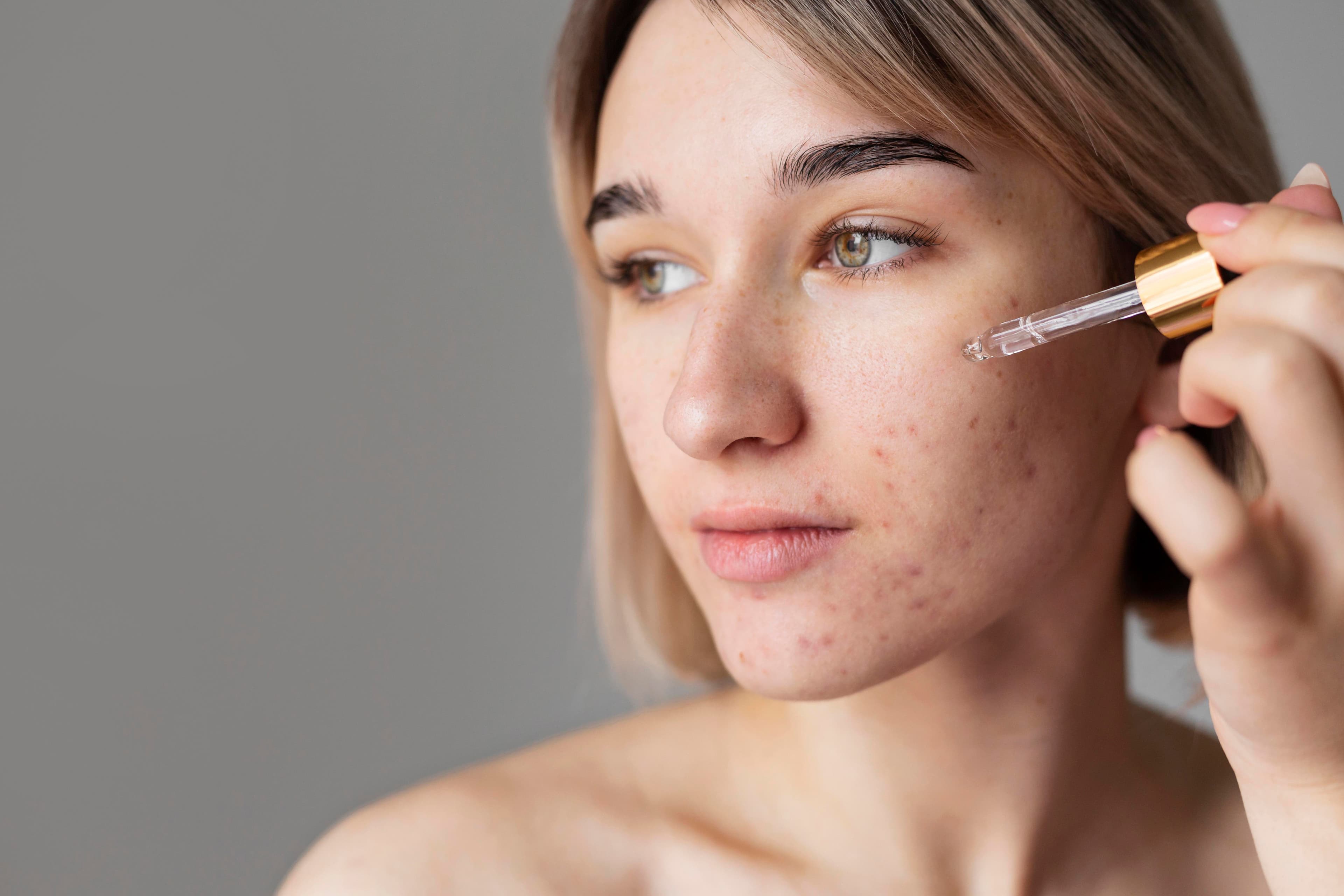 Dermatología